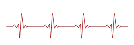 EKG Image